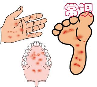 冰球突破-冰球电游豪华版_MG冰球游戏